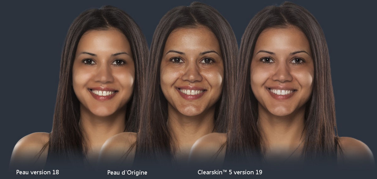 ClearSkin™ 5