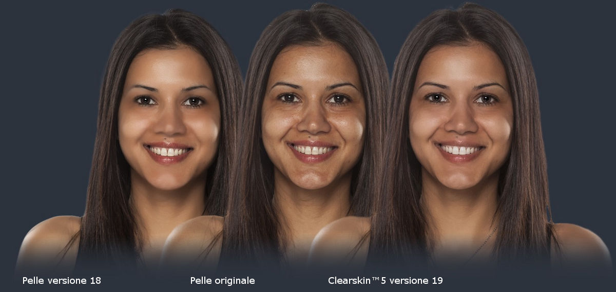 ClearSkin™ 5