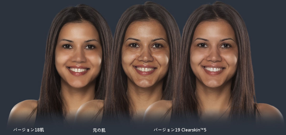 ClearSkin™ 5