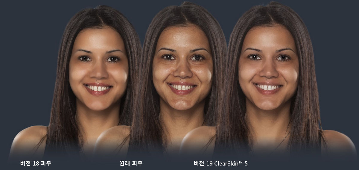 ClearSkin™ 5